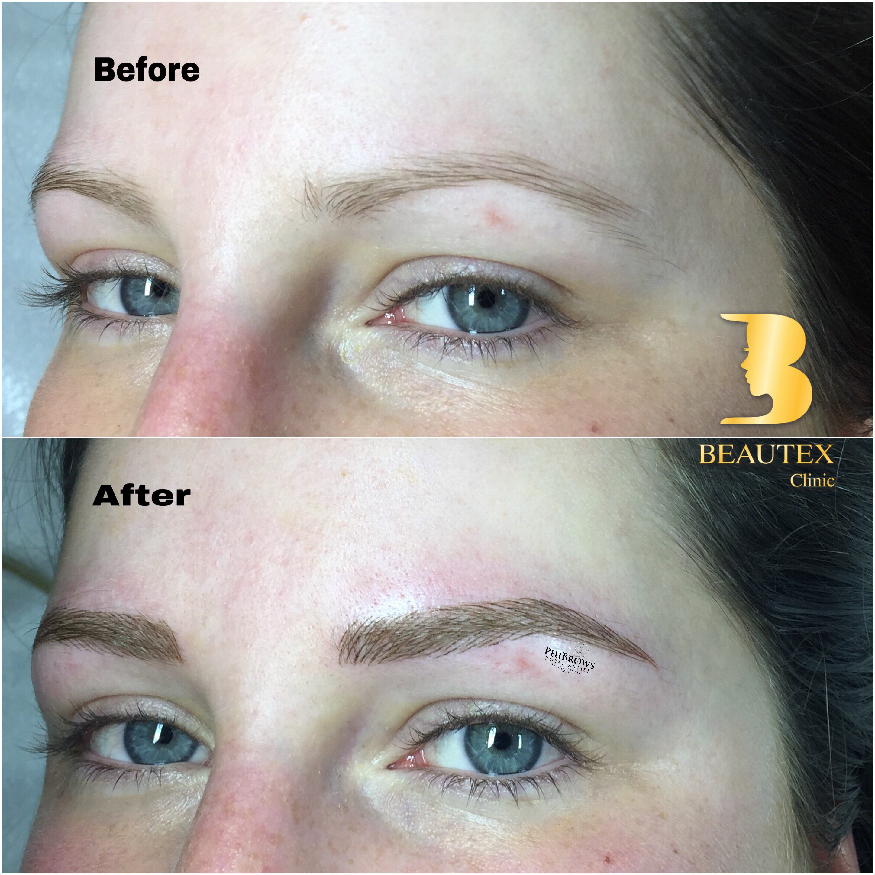 A woman's eyebrows before and after treatment.