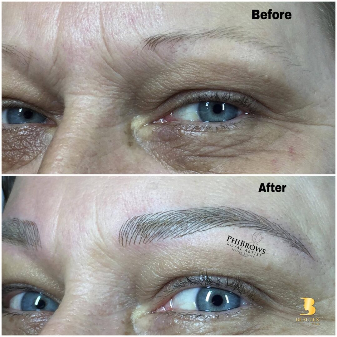 Before and after pictures of a woman's eyebrows.