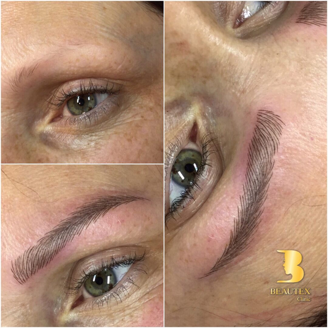 A woman's eyebrows before and after treatment.