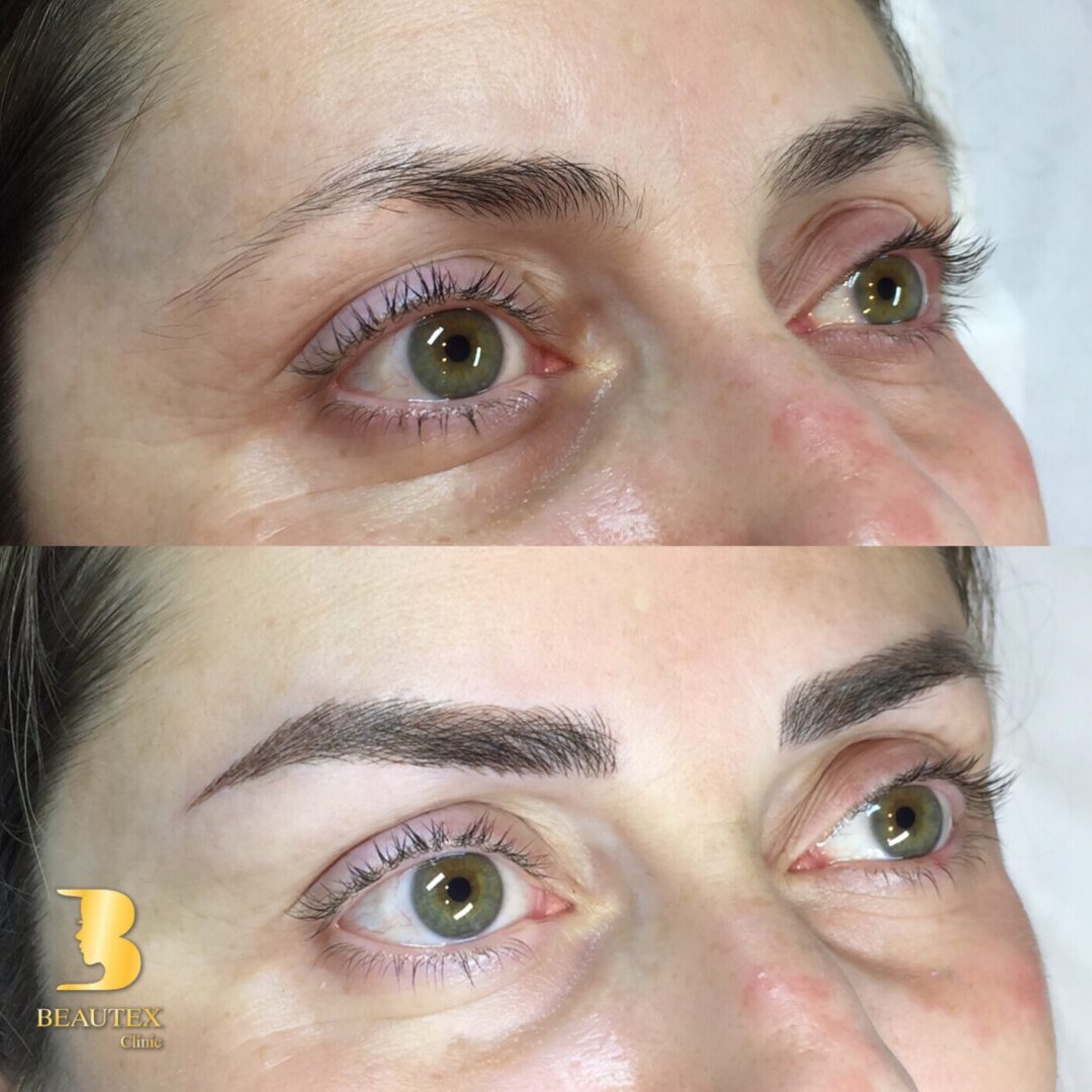 Before and after Microblading